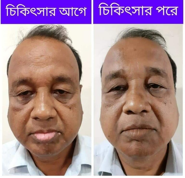WhatsApp-Image-2025-03-24-at-1.39.27-PM-1.jpeg