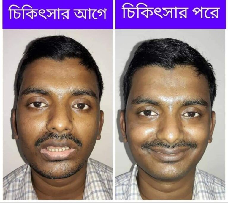 WhatsApp-Image-2025-03-24-at-1.39.29-PM-1.jpeg